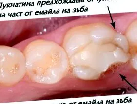 koronákhoz