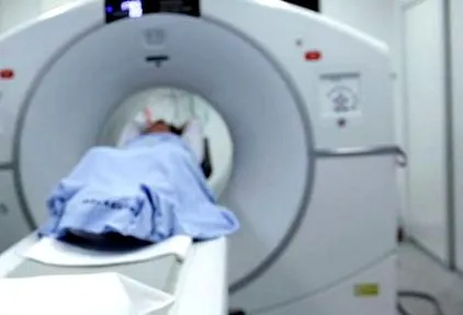 karcinómát diagnosztizálják
