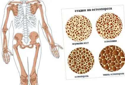hogyan diagnosztizálni