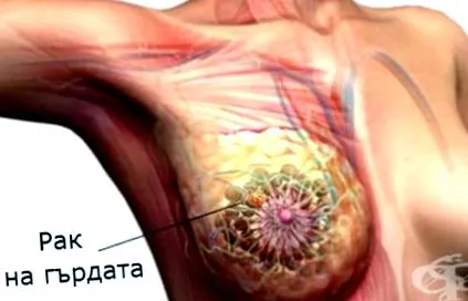 patológia
