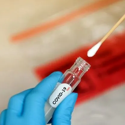 költsége PCR-teszt költsége