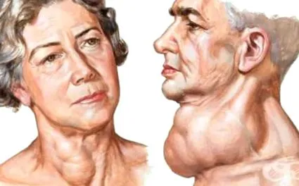 toxikus golyva meghatározott