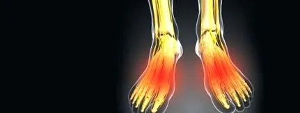 polineuropathia