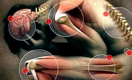 osteoarthritis legfontosabb