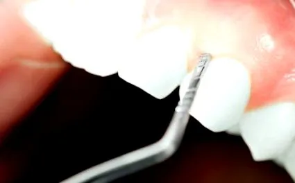 periodontológiai