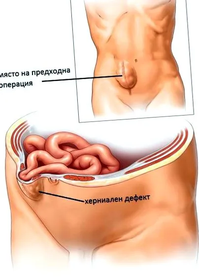 műtét utáni