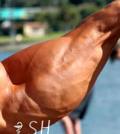 alkar sports
