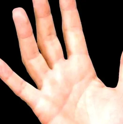 combok ujjak