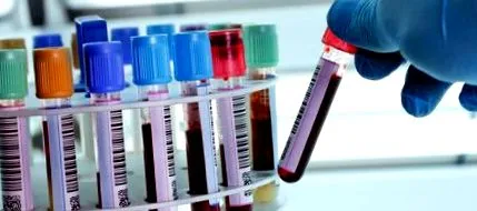 magasabb cirrhosis