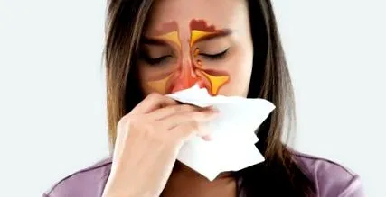 kezelni sinusitis
