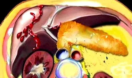 vagy epehólyag trauma