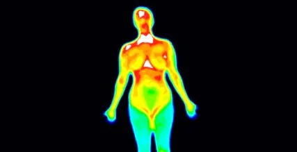 termográfia diagnosztikai