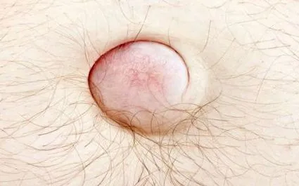 típusai