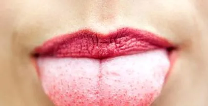 szánk menopauza posztmenopauzás