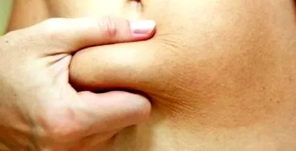 elhízás növeli voice