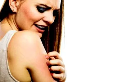 atópiás dermatitis idénye