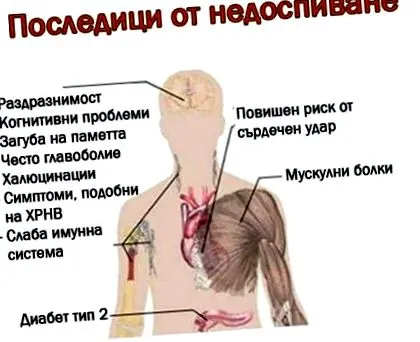alváshiány