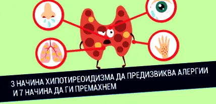 hipotiroidizmus allergiák