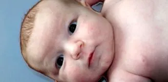 amelyek test különböző bg-mamma