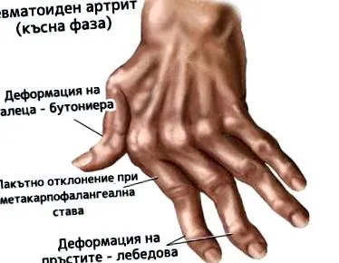 ízületi