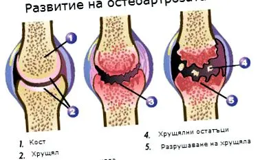 fejlett Biorezonancia terápia