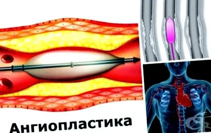 kezelés amelyek csökkentik