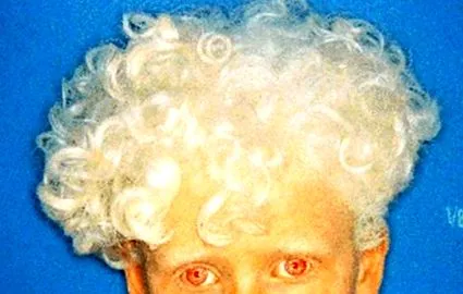 albino ultraibolya sugarak