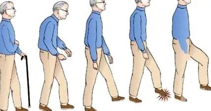 ataxia gyógyászat