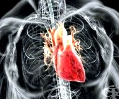 ischaemia szívizom