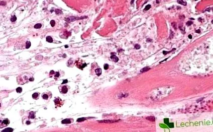 microsporia állatokkal való