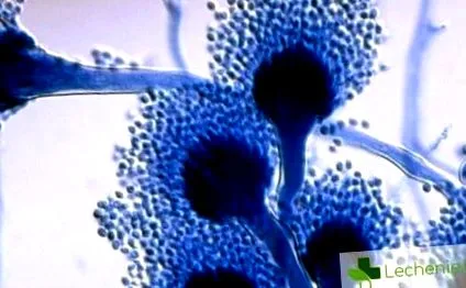 mycosis invazív ilyen típusú