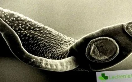 hymenolepidosis hasi fájdalom