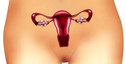 PCOS-ban szenvedő petefészek