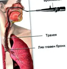 laboratóriumi idegen testek