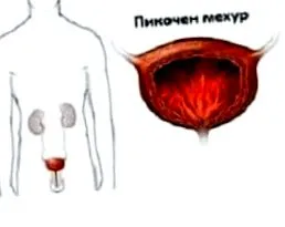 típusú milyen