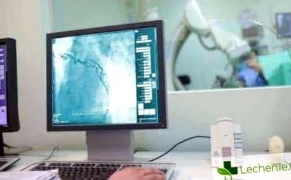 diagnózis vasculitis
