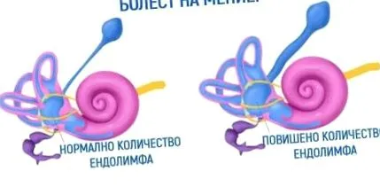 azonban tartós gondolják hogy