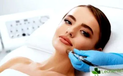 Arcbőrápolás után BLOG peeling