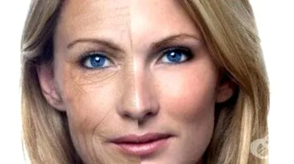ellen