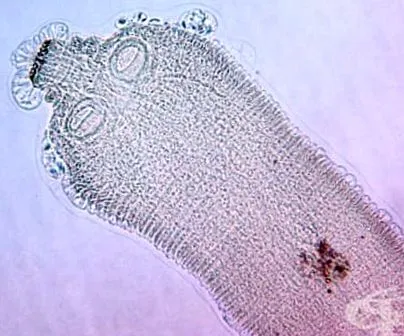 hymenolepidosis emberi testben