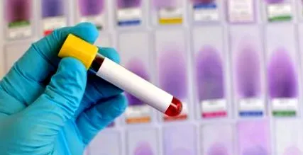hemoglobin