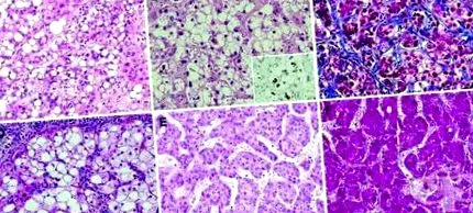 hepatocelluláris