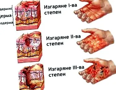 immunhiányos immunhiányos