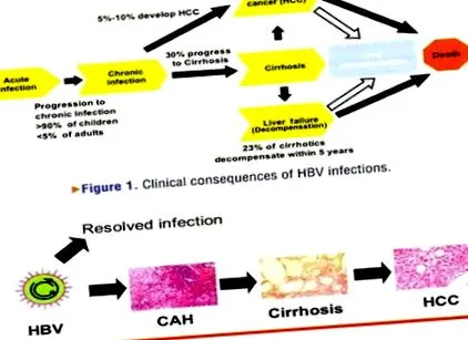 krónikus hepatitis vírusos hepatitis