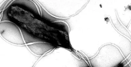 pylori helicobacter