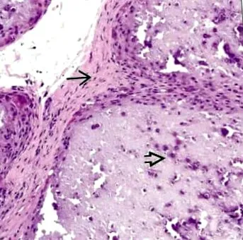 klinikai patológiája Patológia patológiája Patológia