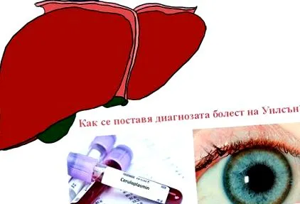 Hogyan diagnosztizálják Hogyan diagnosztizálják