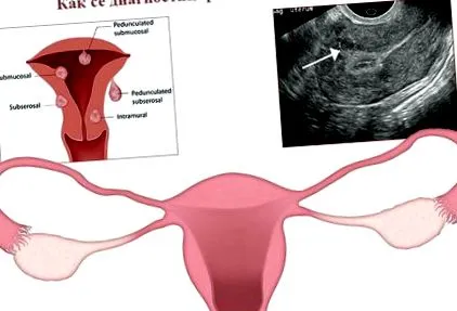 hogyan diagnosztizálható