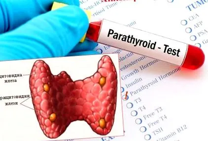 Hogyan diagnosztizálják hypoparathyreosis