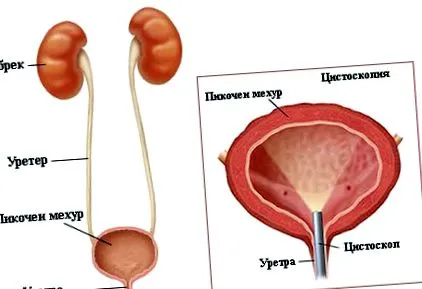diagnosztizálni hólyagdaganatokat diagnosztizálni